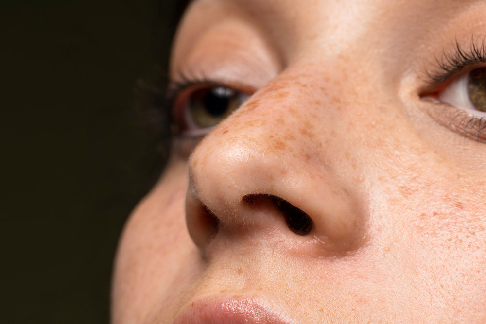 Clogged Pores 101:  How to Prevent Breakouts Before They Start?