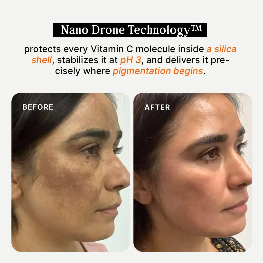 4-Week Hyperpigmentation Treatment purecosmeceuticals