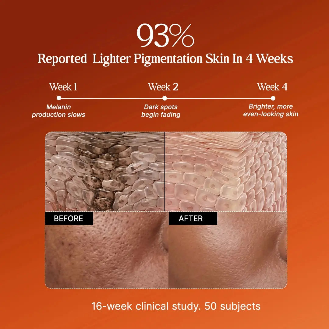 4-Week Hyperpigmentation Treatment purecosmeceuticals