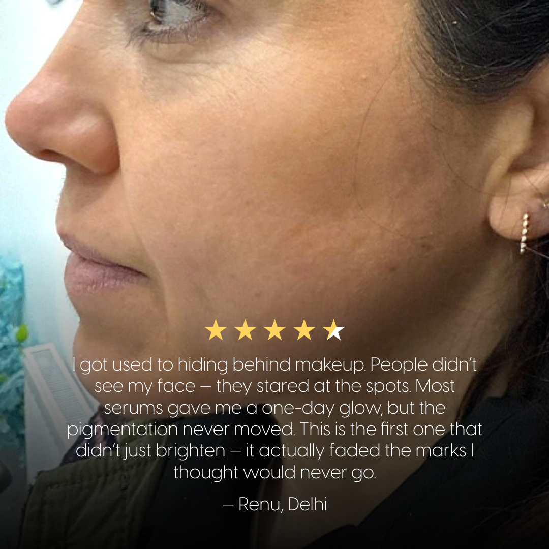4-Week Hyperpigmentation Treatment