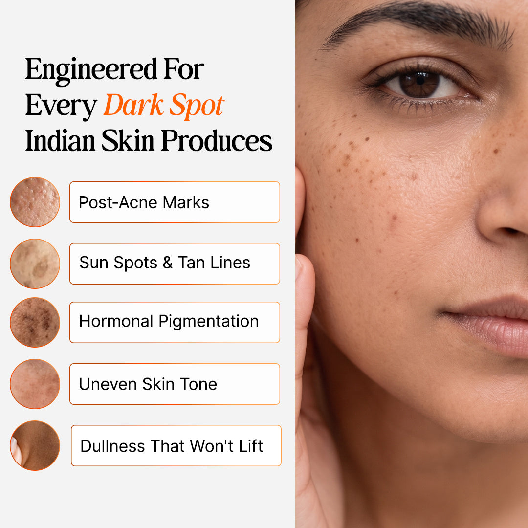4-Week Hyperpigmentation Treatment